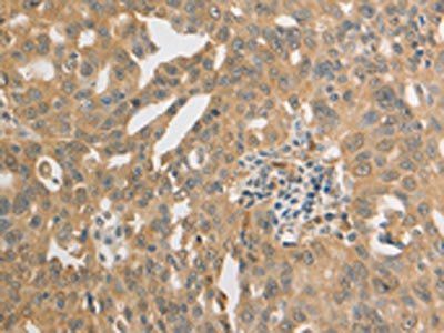 PRDX1 Antibody