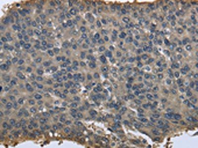 PRDX6 Antibody