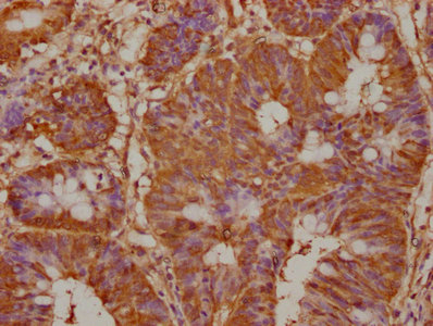 PREP Antibody