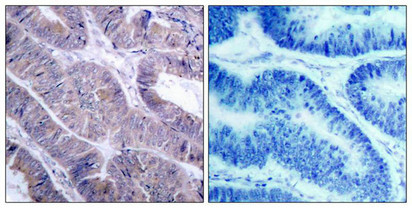 PRKAA1/PRKAA2 Antibody