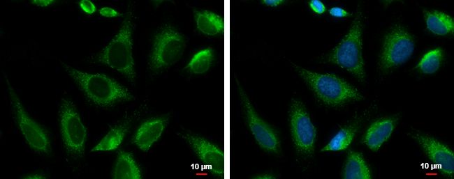 PRKCSH Rabbit Polyclonal Antibody