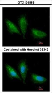PRKCSH Rabbit Polyclonal Antibody