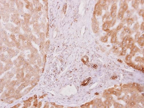 PRKCSH Rabbit Polyclonal Antibody