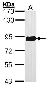 PRKCSH Rabbit Polyclonal Antibody