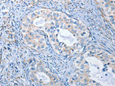 PRKG2 Antibody