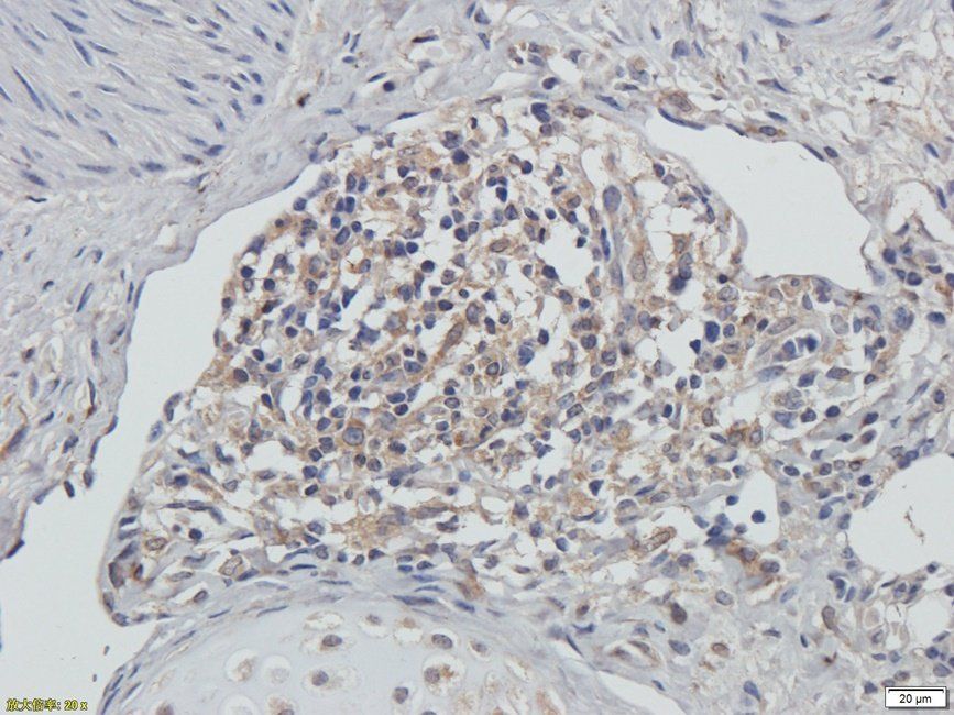 PRKG2 Rabbit Polyclonal Antibody