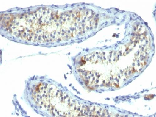 PRLR Antibody