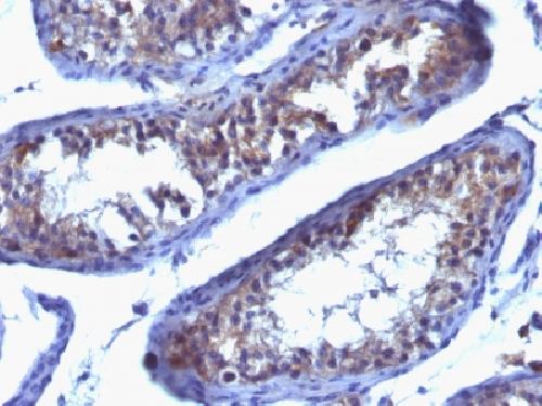 PRLR Antibody