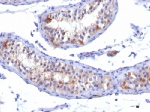 PRLR Antibody