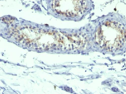 PRLR Antibody