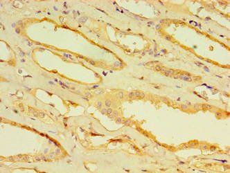 CPVL Antibody