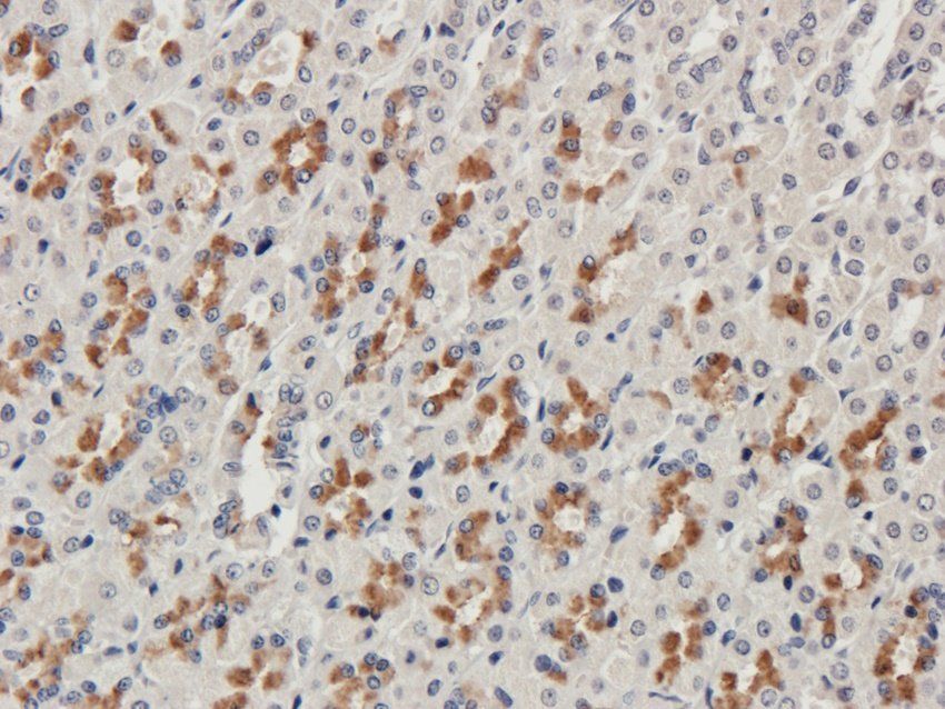 Procollagen type I Rabbit Polyclonal Antibody