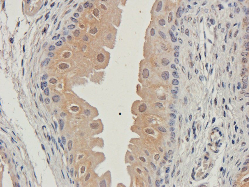 Procollagen type I Rabbit Polyclonal Antibody