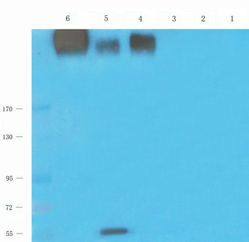 Procollagen type I Rabbit Polyclonal Antibody