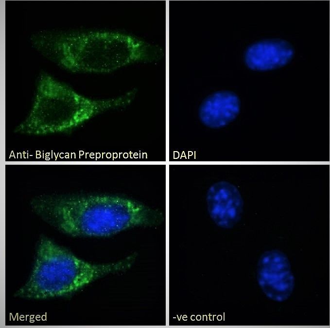 Biglycan Preproprotein Antibody