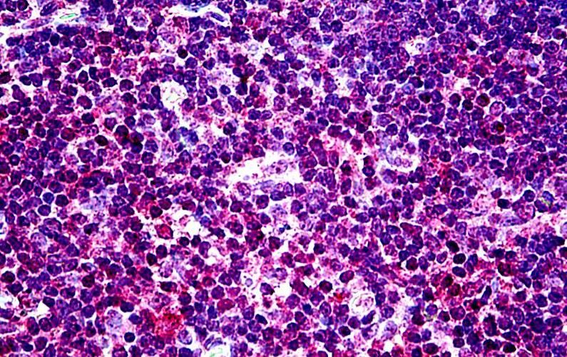 EHD1 Antibody