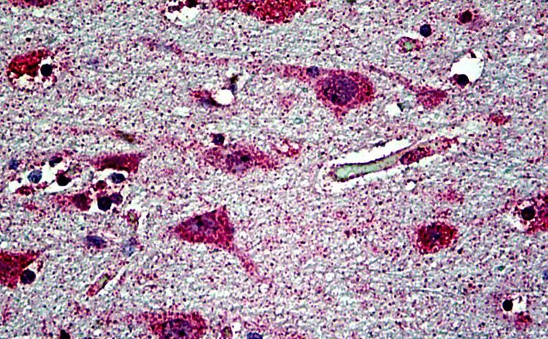 EHD1 Antibody