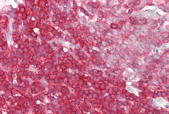 LSP1 Antibody