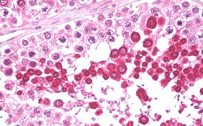 HIPPI Antibody