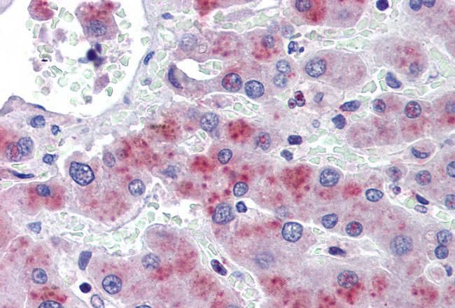 PRKAB2 Antibody
