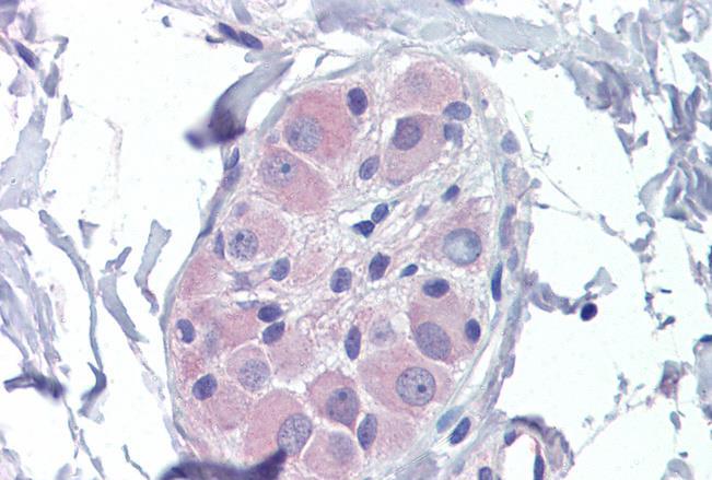 PRKAB2 Antibody