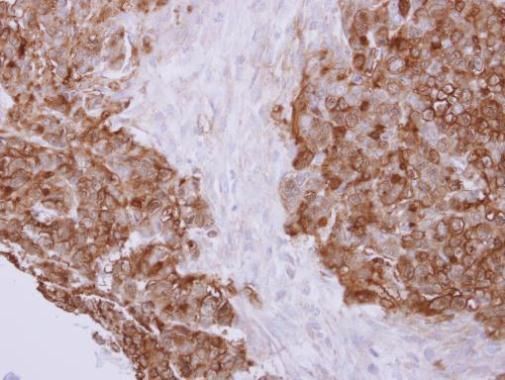 Profilin 2 Rabbit Polyclonal Antibody