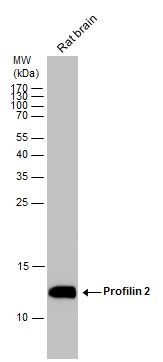 Profilin 2 Rabbit Polyclonal Antibody