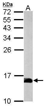 Profilin 2 Rabbit Polyclonal Antibody