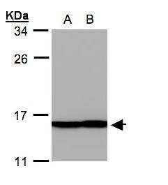 Profilin 2 Rabbit Polyclonal Antibody