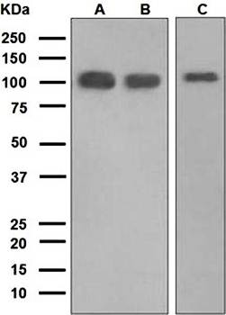 Progesterone Receptor Antibody
