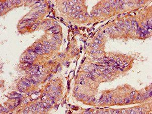 PROKR2 Antibody