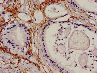 PIP Antibody