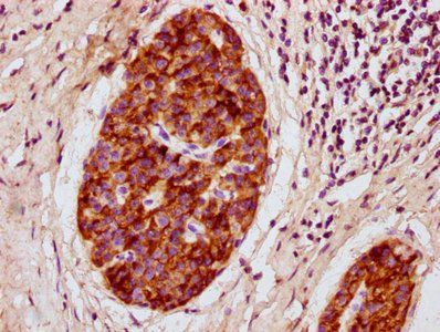Prl Antibody