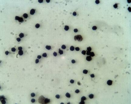 Rabbit anti Human Proprotein convertase subtilisin/kexin type 9 (PCSK9), NARC1 Antibody