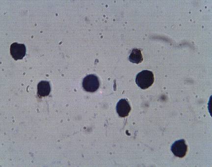 Rabbit anti Human Proprotein convertase subtilisin/kexin type 9 (PCSK9), NARC1