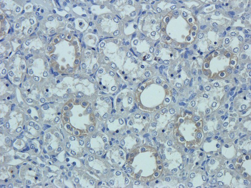 Prostaglandin E synthase 2 Rabbit Polyclonal Antibody