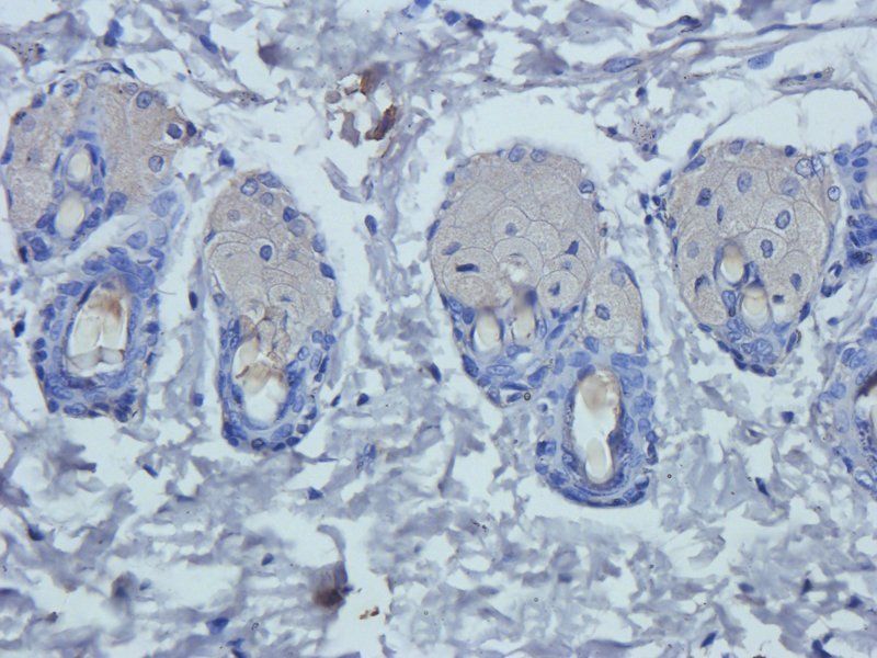 Prostaglandin E synthase 2 Rabbit Polyclonal Antibody