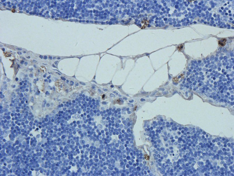 Prostaglandin E synthase 2 Rabbit Polyclonal Antibody