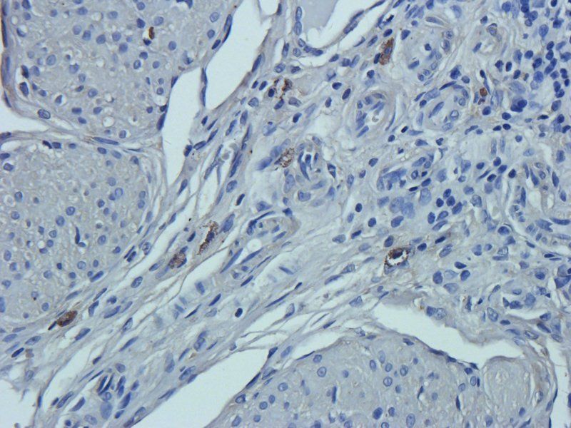 Prostaglandin E synthase 2 Rabbit Polyclonal Antibody
