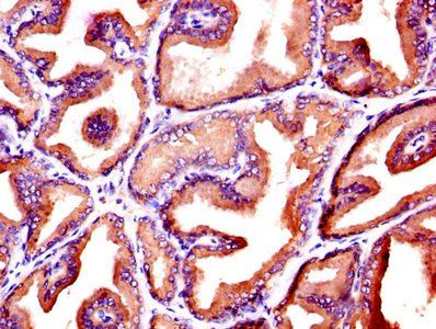 KLK3 Antibody