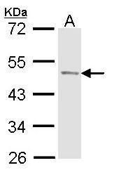 CIAPIN1 Rabbit Polyclonal Antibody