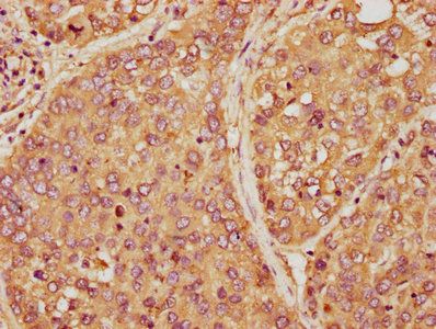 AMBP Antibody