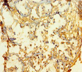 ATOH1 Antibody