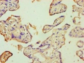 DLK1 Antibody