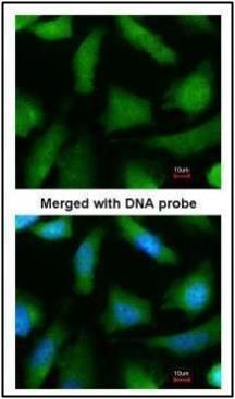 PSMA6 Rabbit Polyclonal Antibody