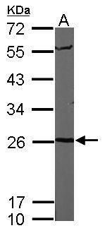 PSMA6 Rabbit Polyclonal Antibody
