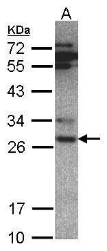 PSMA6 Rabbit Polyclonal Antibody