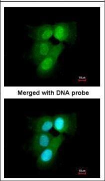 PSMA6 Rabbit Polyclonal Antibody