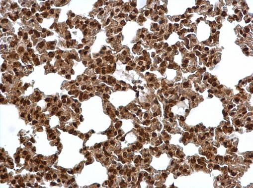 PSMA6 Rabbit Polyclonal Antibody