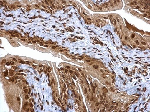 PSMA6 Rabbit Polyclonal Antibody